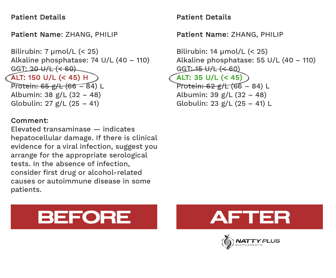 ULTIMATE LIVER SUPPORT